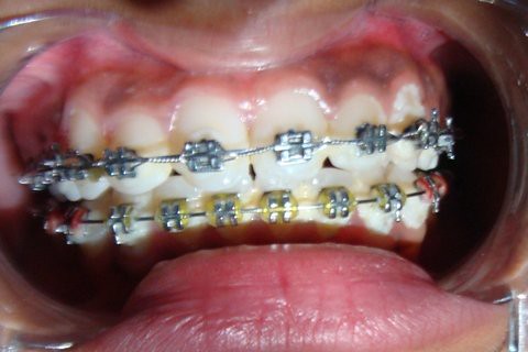  Your Ultimate Destination for Orthodontic Treatment